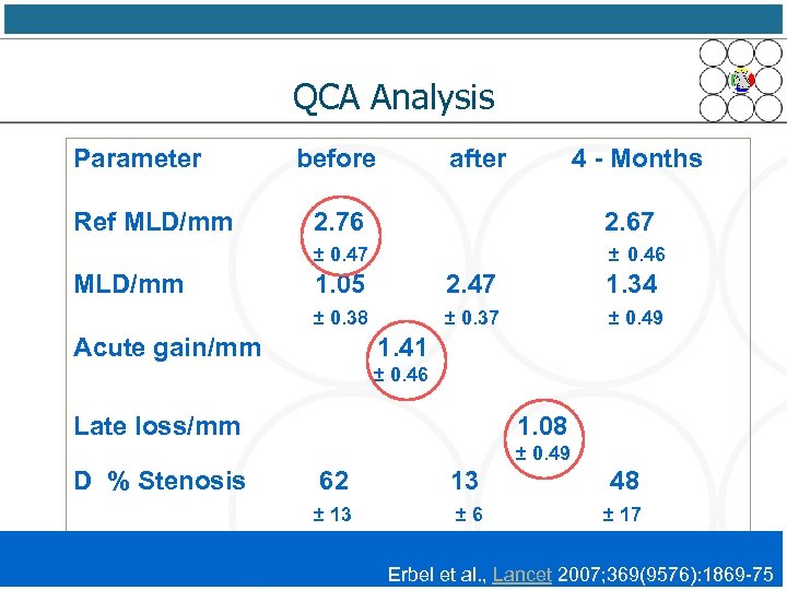 QCA Analysis Parameter Ref MLD/mm before after 4 - Months 2. 67 ± 0.