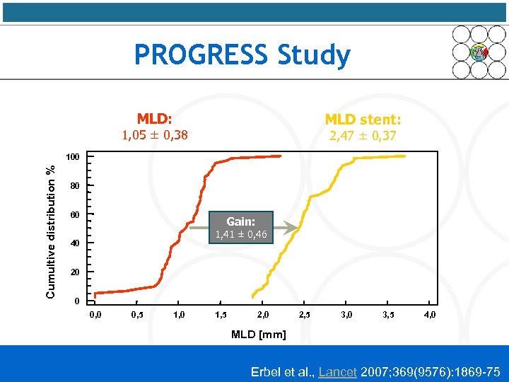 PROGRESS Study MLD: MLD stent: 1, 05 ± 0, 38 2, 47 ± 0,