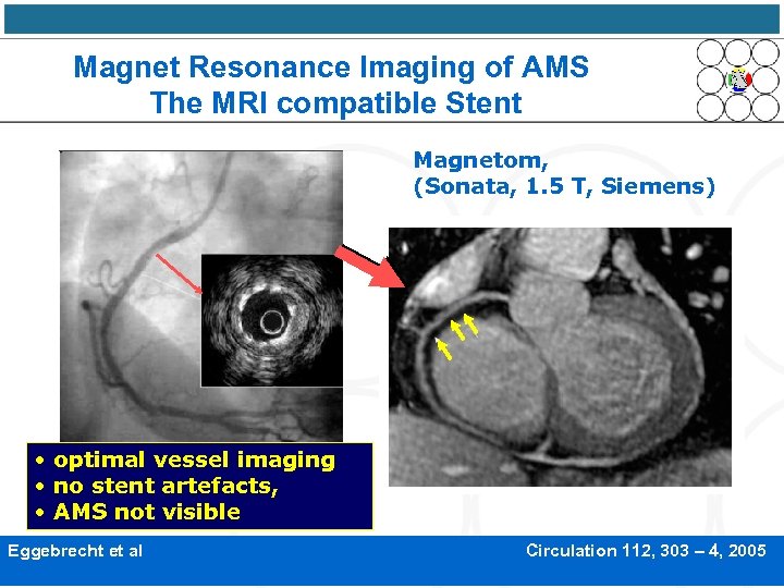 Magnet Resonance Imaging of AMS The MRI compatible Stent Magnetom, (Sonata, 1. 5 T,