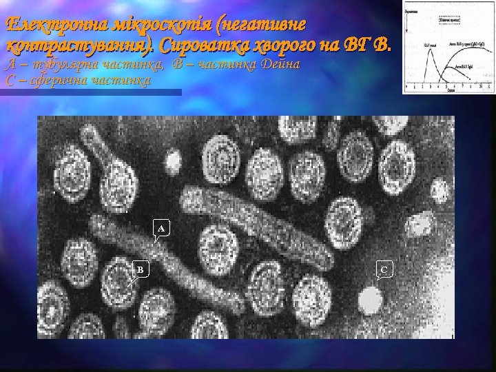 Електронна мікроскопія (негативне контрастування). Сироватка хворого на ВГ В. А – тубулярна частинка, В