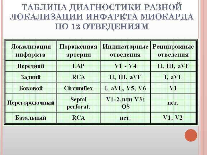 ТАБЛИЦА ДИАГНОСТИКИ РАЗНОЙ ЛОКАЛИЗАЦИИ ИНФАРКТА МИОКАРДА ПО 12 ОТВЕДЕНИЯМ 