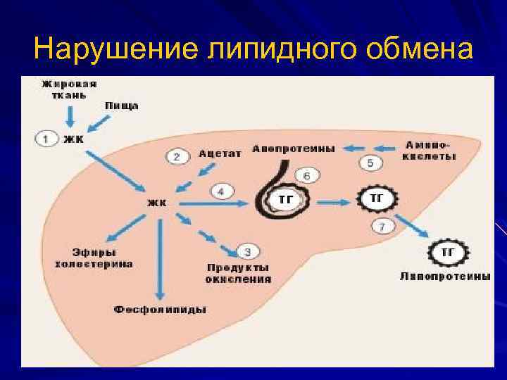 Нарушение липидного обмена 