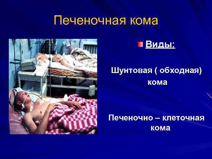 Печеночная кома Виды: Шунтовая ( обходная) кома Печеночно – клеточная кома 