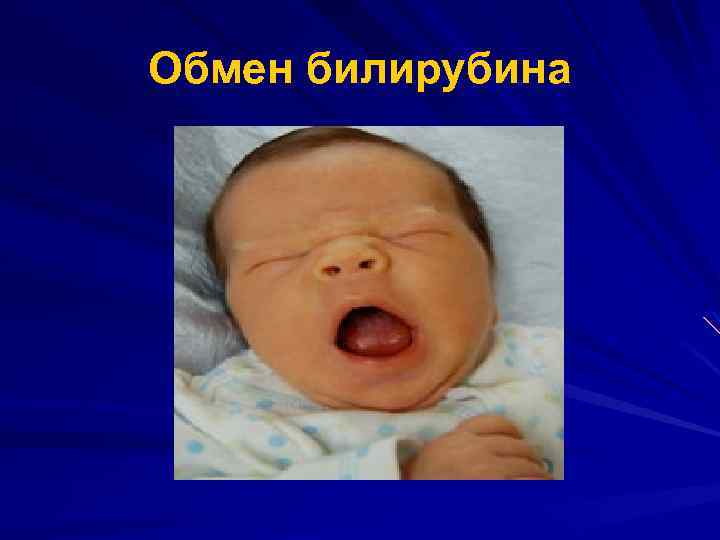 Обмен билирубина 