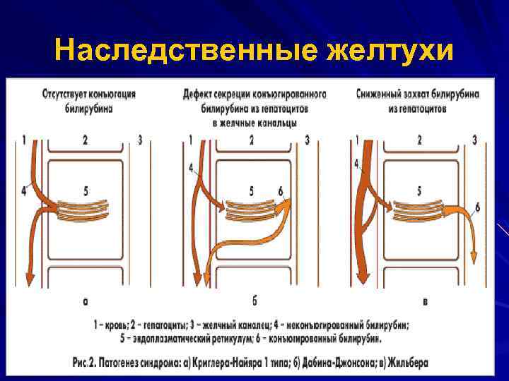 Наследственные желтухи 