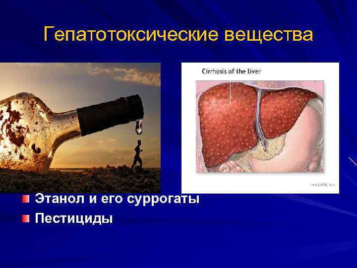 Гепатотоксические вещества Этанол и его суррогаты Пестициды 
