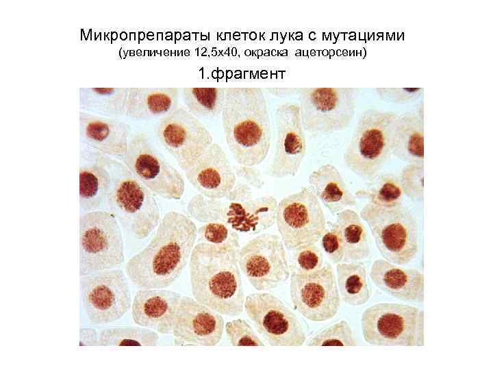 Микропрепараты клеток лука с мутациями (увеличение 12, 5 х40, окраска ацеторсеин) 1. фрагмент 