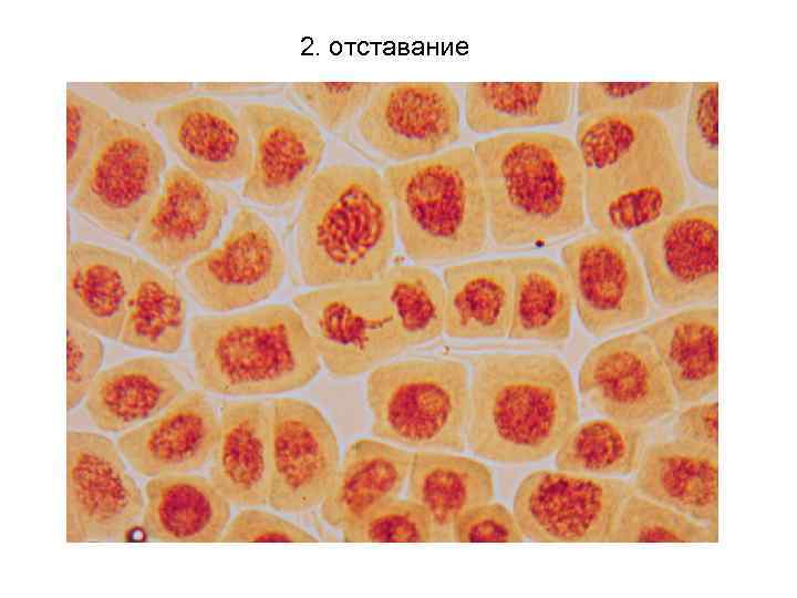 2. отставание 