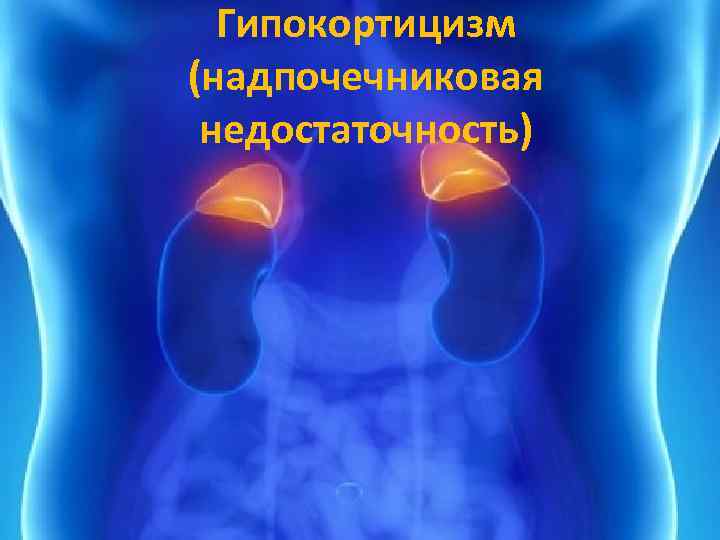 Гипокортицизм (надпочечниковая недостаточность) 