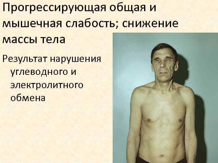 Прогрессирующая общая и мышечная слабость; снижение массы тела Результат нарушения углеводного и электролитного обмена