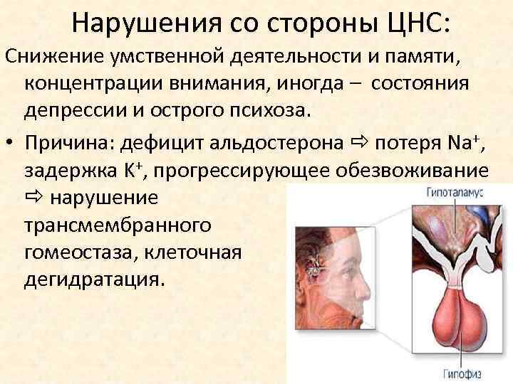 Нарушения со стороны ЦНС: Снижение умственной деятельности и памяти, концентрации внимания, иногда – состояния