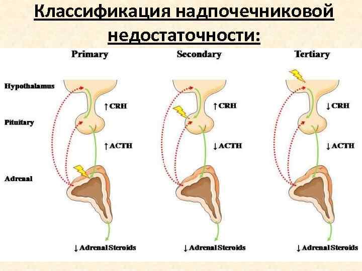Классификация надпочечниковой недостаточности: • Первичная: поражение коры надпочечников; • Вторичная: нарушение секреции АКТГ •