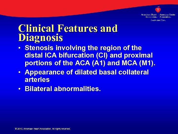 Clinical Features and Diagnosis • Stenosis involving the region of the distal ICA bifurcation