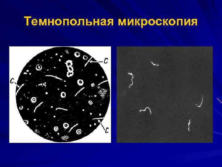 Темнопольная микроскопия