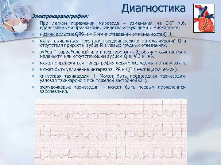 Регистрация экг. Дифтерийный миокардит ЭКГ. Вирусный миокардит ЭКГ. Инфекционный миокардит ЭКГ. Миокардит симптоматика ЭКГ.