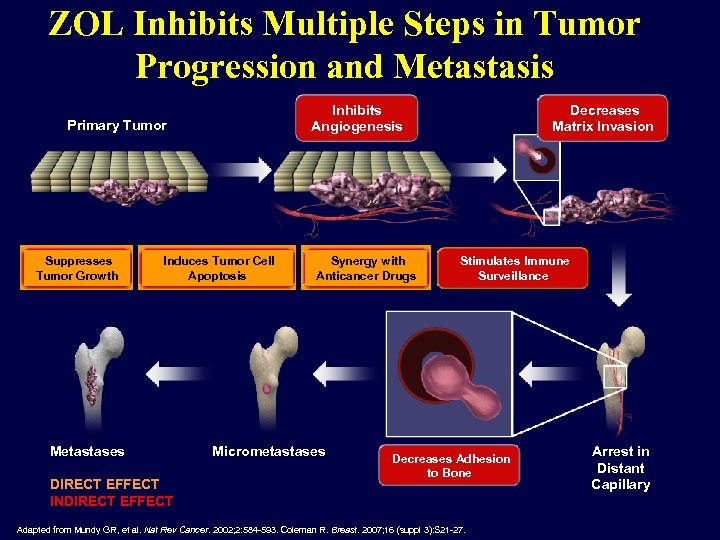 ZOL Inhibits Multiple Steps in Tumor Progression and Metastasis Inhibits Angiogenesis Primary Tumor Suppresses