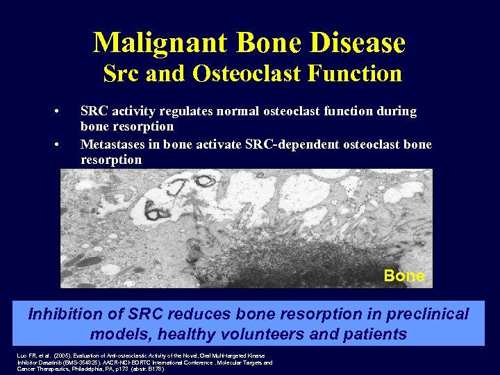 Malignant Bone Disease Src and Osteoclast Function • • SRC activity regulates normal osteoclast