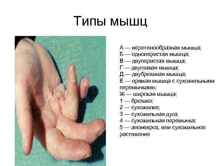 Типы мышц А — веретенообразная мышца; Б — одноперистая мышца; В — двуперистая мышца;