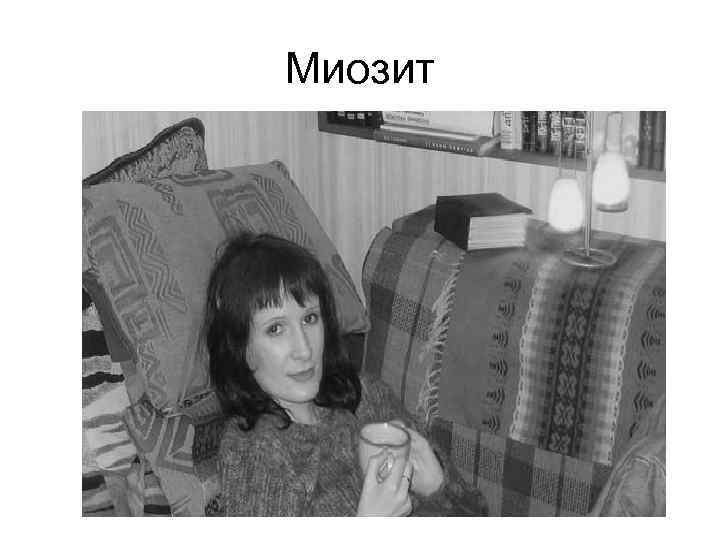 Миозит 