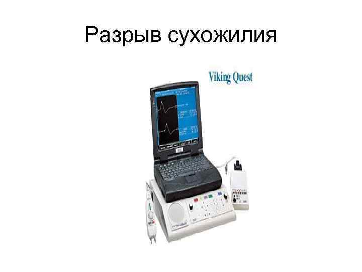 Разрыв сухожилия 