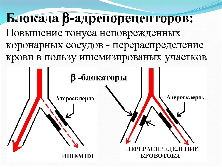 Блокада -адренорецепторов: Повышение тонуса неповрежденных коронарных сосудов - перераспределение крови в пользу ишемизированых участков