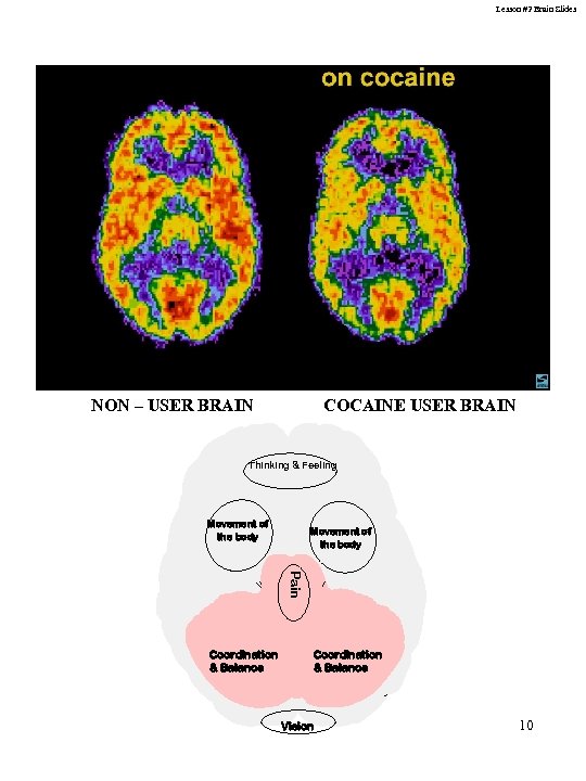 Lesson #2 Brain Slides NON – USER BRAIN COCAINE USER BRAIN Thinking & Feeling