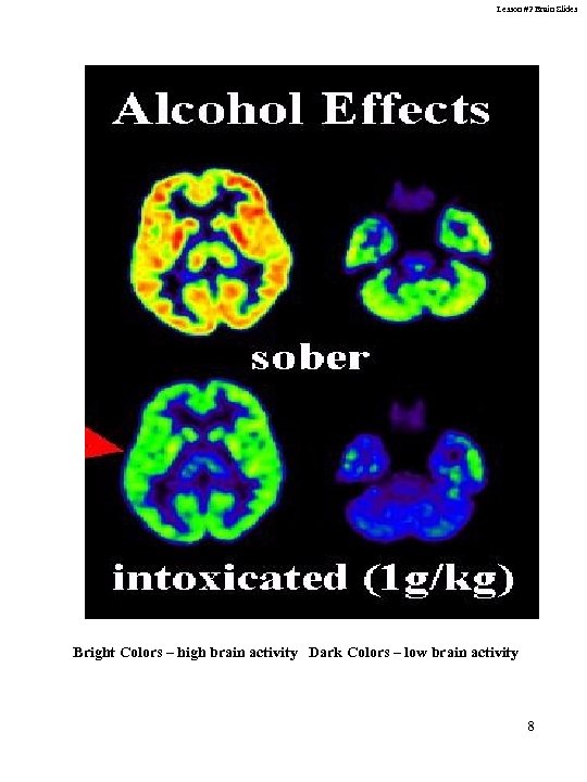 Lesson #2 Brain Slides Bright Colors – high brain activity Dark Colors – low