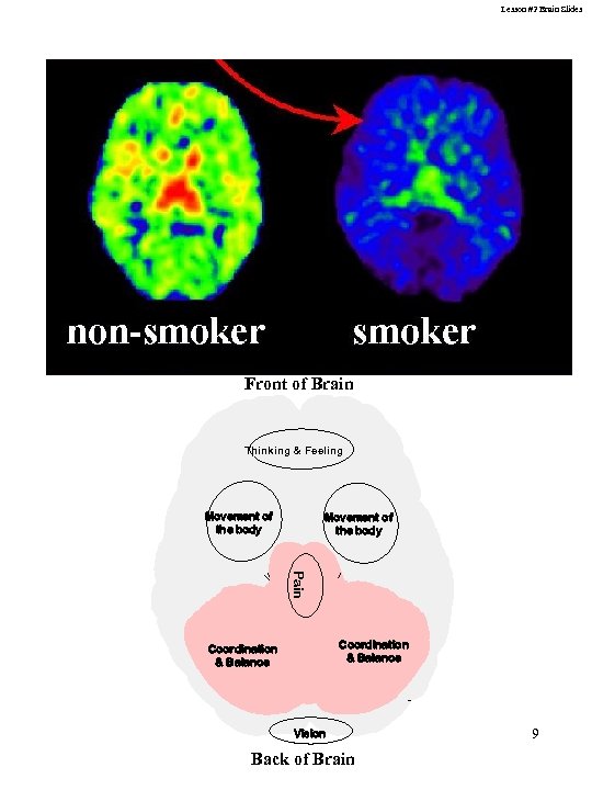 Lesson #2 Brain Slides Front of Brain Thinking & Feeling Movement of the body