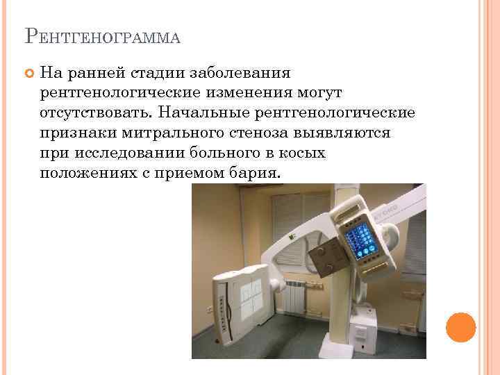 РЕНТГЕНОГРАММА На ранней стадии заболевания рентгенологические изменения могут отсутствовать. Начальные рентгенологические признаки митрального стеноза