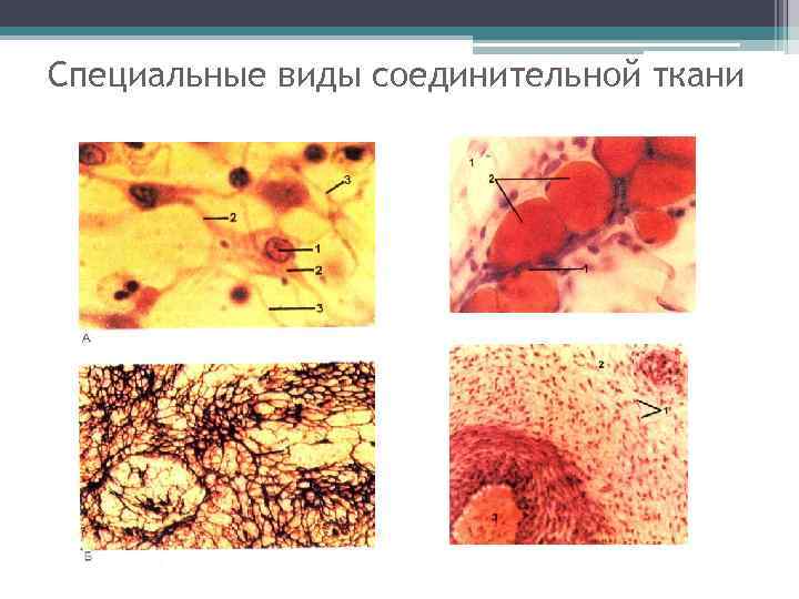 Соединительная ткань рниму презентация