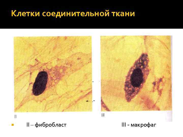 Собственная ткань. Макрофаги соединительной ткани. Макрофаги,фибробласты соединительной ткани. Клетки соединительной ткани макрофаги. Макрофаг в рыхлой соединительной ткани.