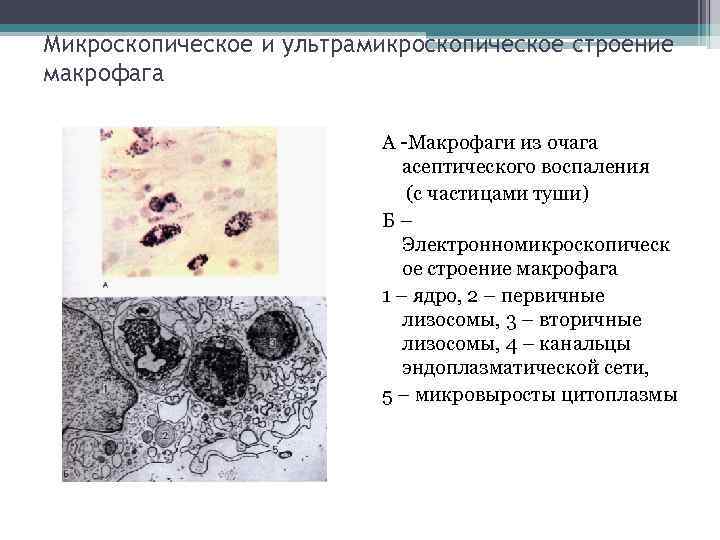 Микроскопическое и ультрамикроскопическое строение макрофага А -Макрофаги из очага асептического воспаления (с частицами туши)