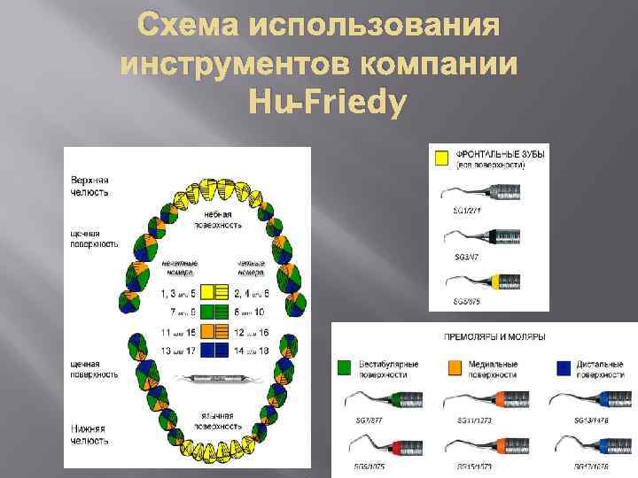 Схема использования инструментов компании Hu-Friedy 