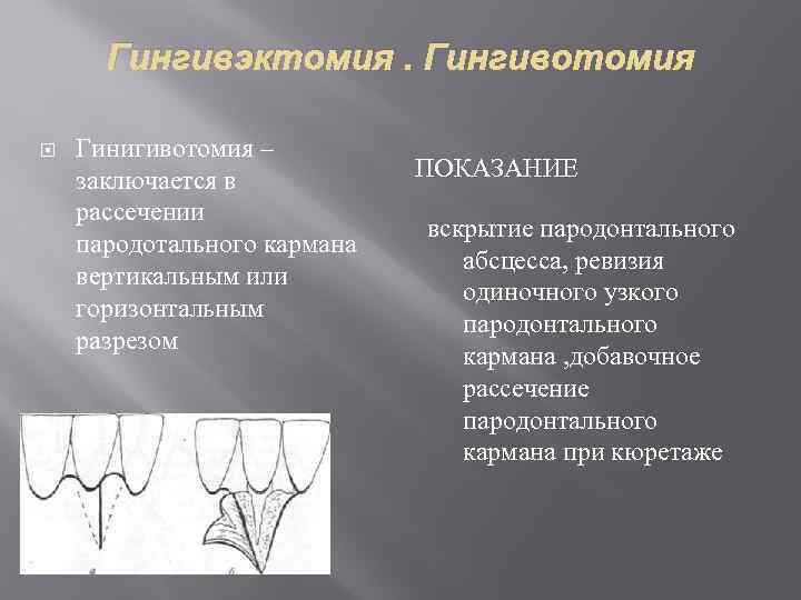 Гингивэктомия. Гингивотомия Гинигивотомия – заключается в рассечении пародотального кармана вертикальным или горизонтальным разрезом ПОКАЗАНИЕ