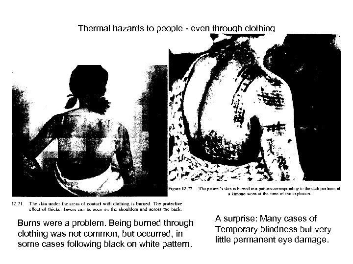 Thermal hazards to people - even through clothing Burns were a problem. Being burned