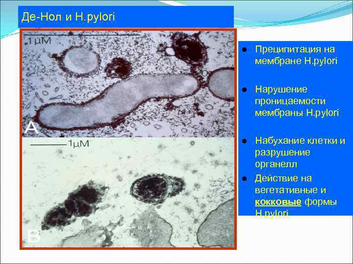 Де-Нол и Н. pylori l Преципитация на мембране H. pylori l Нарушение проницаемости мембраны