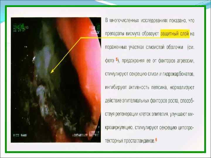 Язвенная болезнь желудка карта вызова скорой медицинской