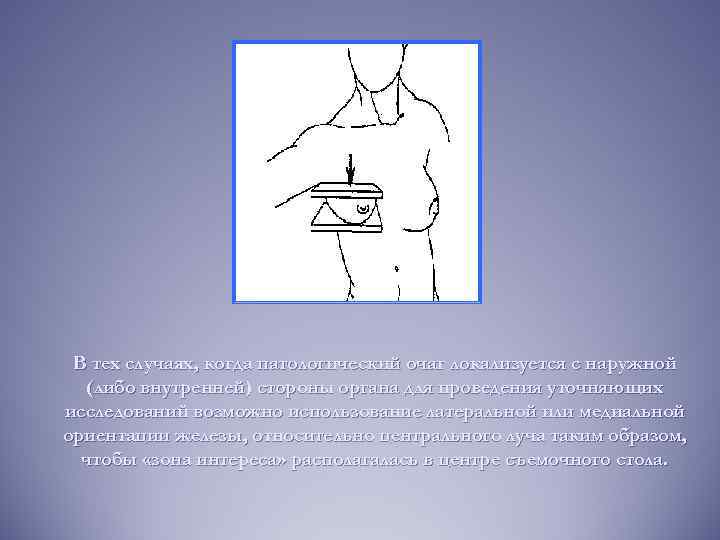 В тех случаях, когда патологический очаг локализуется с наружной (либо внутренней) стороны органа для