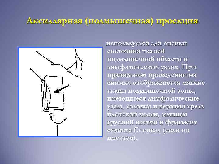 Аксиллярная (подмышечная) проекция используется для оценки состояния тканей подмышечной области и лимфатических узлов. При