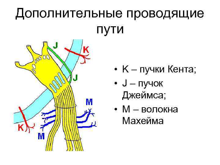 Дополнительные проводящие пути • K – пучки Кента; • J – пучок Джеймса; •