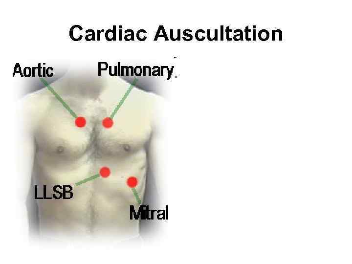 Cardiac Auscultation 