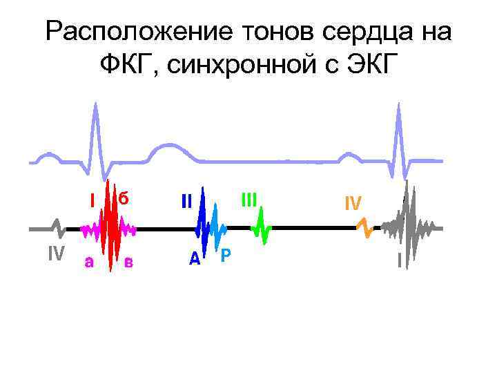 Тоны сердца схема