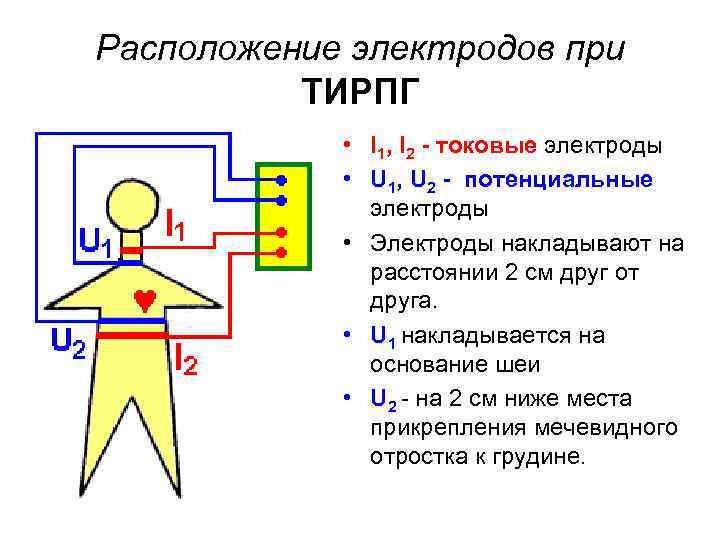 Расположение электродов при ТИРПГ • I 1, I 2 - токовые электроды • U