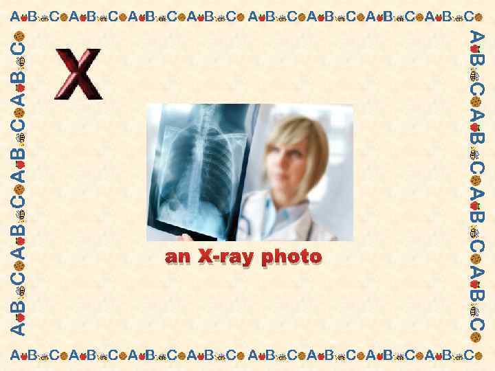 an X-ray photo 