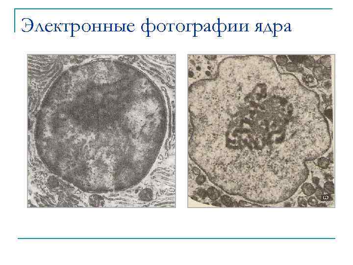 Электронные фотографии ядра 