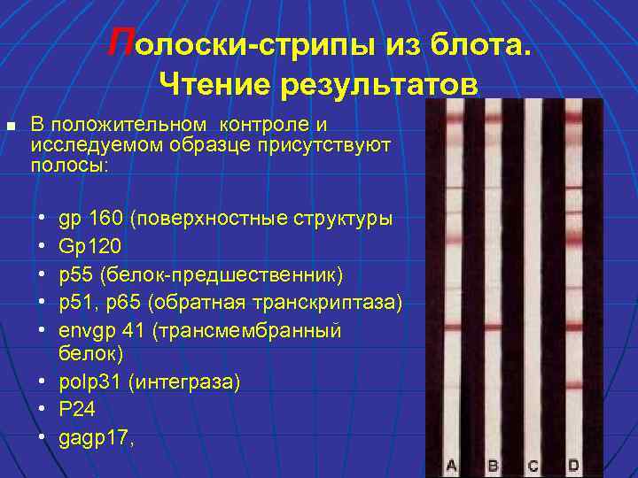 Полоски-стрипы из блота. Чтение результатов n В положительном контроле и исследуемом образце присутствуют полосы: