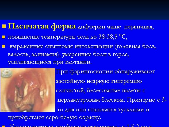 n Пленчатая форма дифтерии чаще первичная, n n повышение температуры тела до 38 -38,
