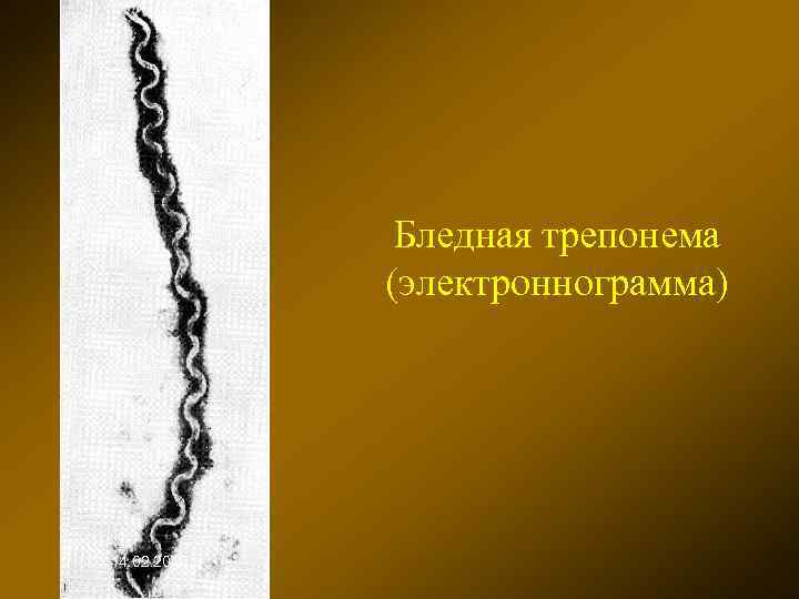 Бледная трепонема (электроннограмма) 14. 02. 2018 