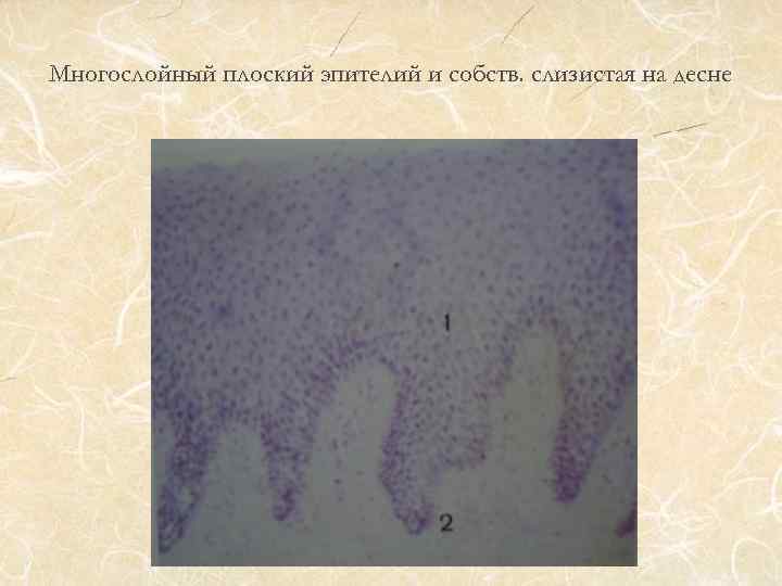 Многослойный плоский эпителий и собств. слизистая на десне 