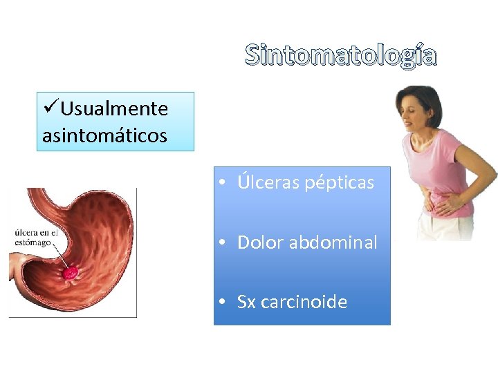 Sintomatología üUsualmente asintomáticos • Úlceras pépticas • Dolor abdominal • Sx carcinoide 